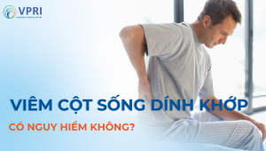 Viêm cột sống dính khớp có nguy hiểm không